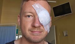 Dziennikarz o2.pl postrzelony z wiatrówki. Trafił do szpitala