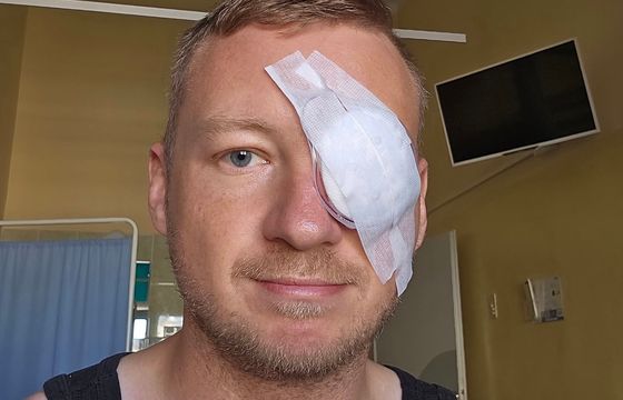 Dziennikarz o2.pl postrzelony z wiatrówki. Trafił do szpitala