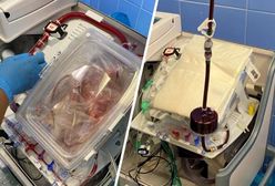 Spektakularna akcja lekarzy. Przewieźli jeszcze bijące serce ze Słowacji do Czech