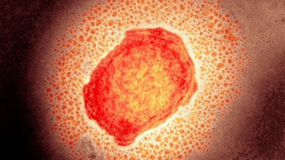 Pierwszy przypadek małpiej ospy u naszych sąsiadów 