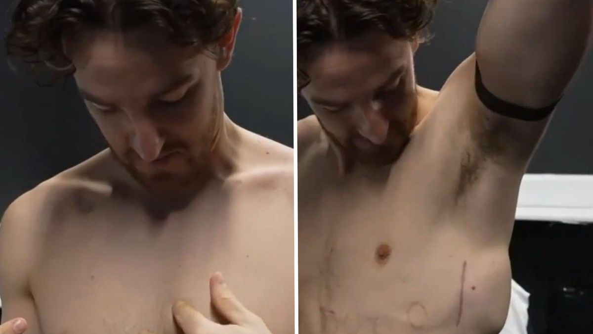 Tom Lockyer pokazał miejsce wszczepienia urządzenia