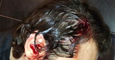 "Polowanie na gejów" pod krakowskim klubem. Brutalny atak
