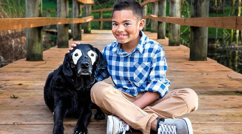 8-latek z bielactwem spotkał psa z podobnym stanem skóry. Teraz są nierozłączni