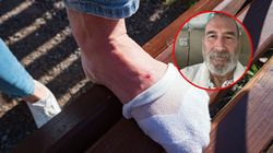 Objaw zauważył na spacerze z psem. Diagnoza była wstrząsem dla Roberta