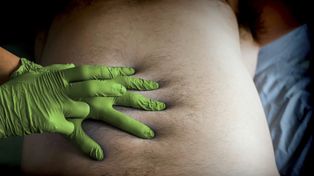 Nawet dwukrotnie wyższe ryzyko. Alkohol zwiększa ryzyko rzadkiego raka