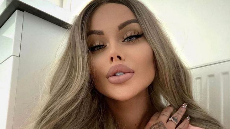 Fani zarzucają Ewel0nie operację bioder