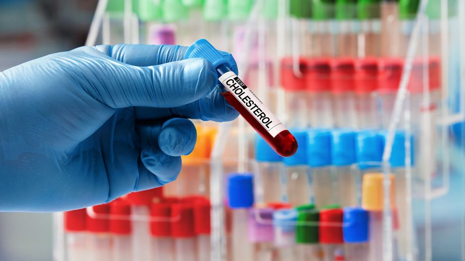 Doctor hand taking a blood sample tube from a rack in the laboratory / Technician holding tube with label Cholesterol in the blood bank laboratoryblood, tube, test, doctor, sample, cholesterol, technician, blood test, blood tube, laboratory, analysis, triglyceride, cardiovascular, hyperlipidemia, cardiac, hypercholesterolemia, coronary, anemia, medicine, hematology, health, care, hand, holding, plasma, analytical, text, label, practitioner, physician, technician, sick, disease, nurse, biology, lab, diagnostic, diagnosis, medical, disease, health care, bank, test tube, medical sample, investigation, extraction, patient, analyzing, microbiology, hospital, blood, tube, test, doctor, sample, cholesterol, technician, blood test, blood tube, laboratory, analysis, triglyceride, cardiovascular, hyperlipidemia, cardiac, hypercholesterolemia, coronary, anemia, medicine, hematology, health, care, hand, holding, plasma, analytical, text, label, practitioner, physician, sick, disease, nurse, biology, lab, diagnostic, diagnosis, medical, health care, bank, test tube, medical sample, investigation, extraction, patient, analyzing, microbiology, hospital