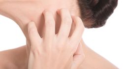 Plamy na skórze, swędzenie, łuszczenie - i ty możesz mieć grzybicę!