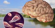 Naegleria fowleri atakuje. Grasuje w ciepłych kąpieliskach