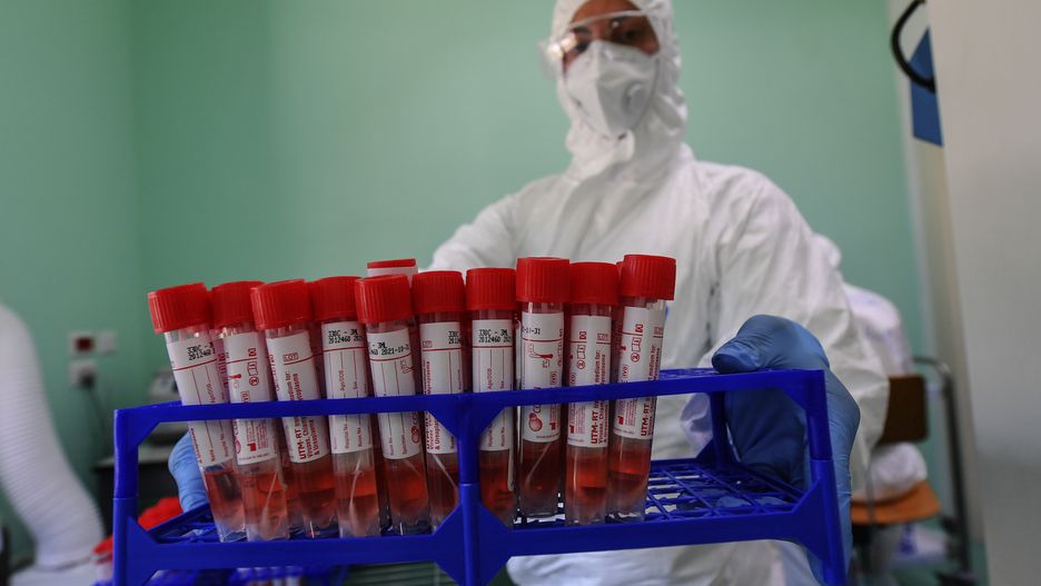 Szczepionka na koronawirusa. Obiecujące wyniki testów