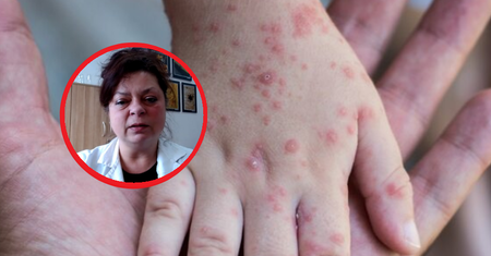 Zapomniana choroba atakuje w Polsce. "Będą epidemie wyrównawcze"