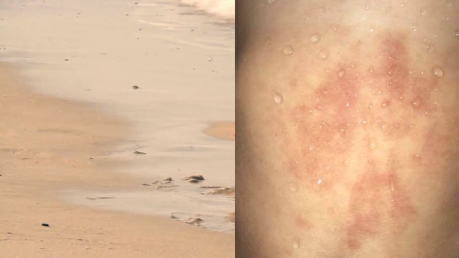 W piasku i w wodzie mogą znajdować się bakterie coli