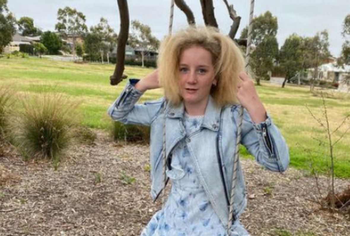 Dziewczynka z włosami jak Einstein ma już 12 lat