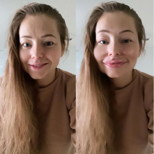 Agata Rubik pokazała, jak wyglądałaby z wypełniaczami w twarzy