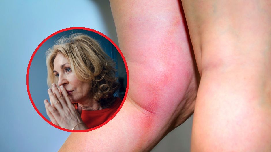 Masz problemy naczyniowe? To może przyspieszać starzenie się mózgu