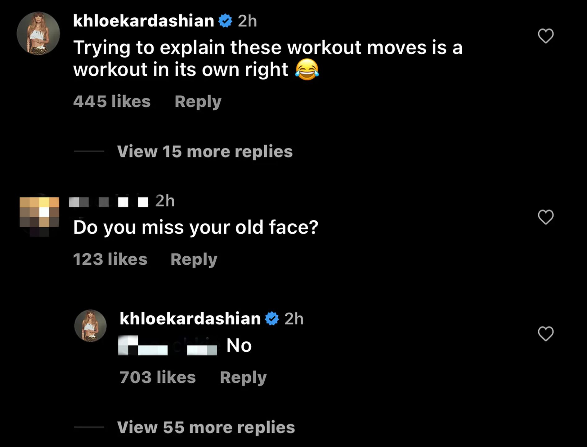 Khloe Kardashian