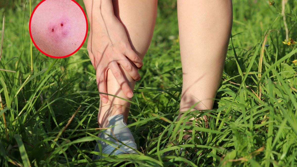 Kolejne ukąszenie przez żmije. Eksperci wyjaśniają krok po kroku, co robić