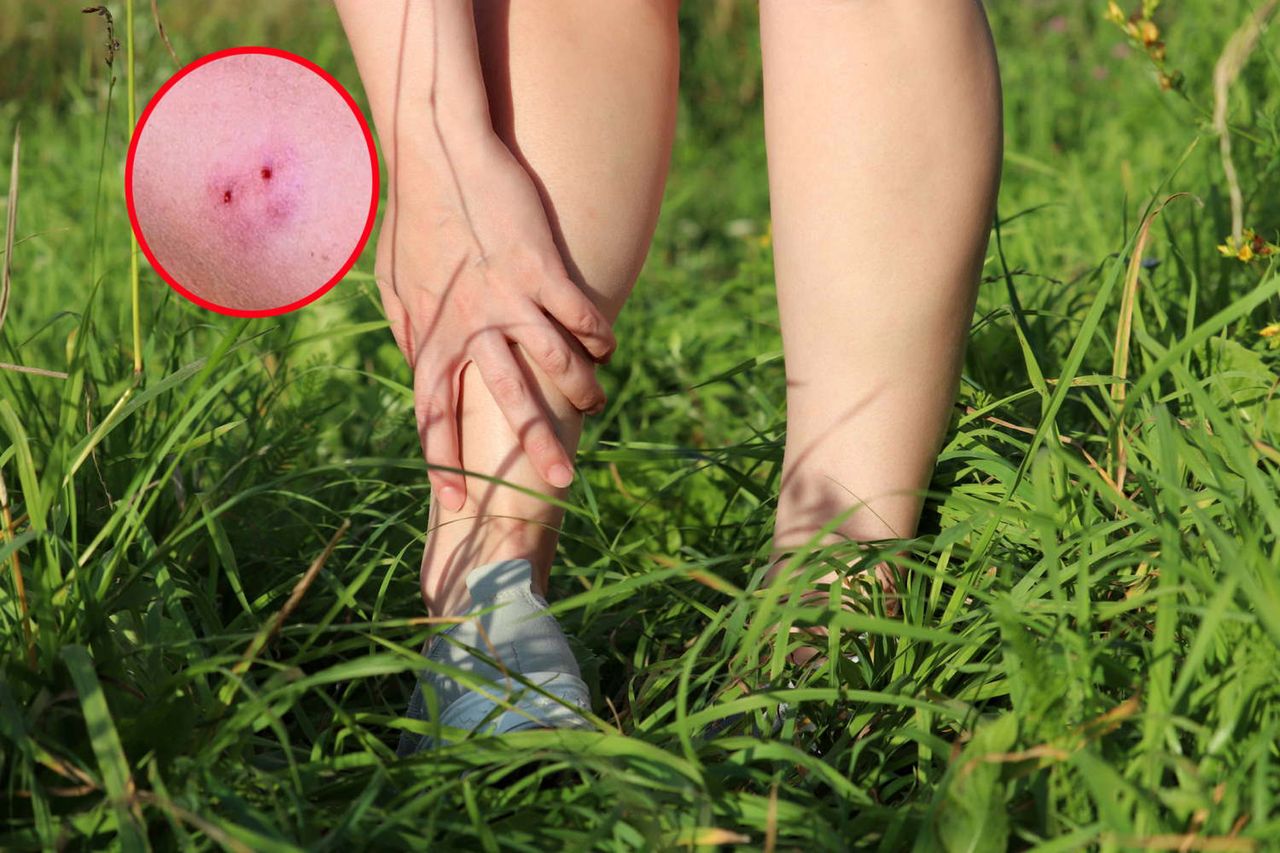 Ratownicy i lekarze ostrzegają przed żmijami. Błąd może kosztować życie