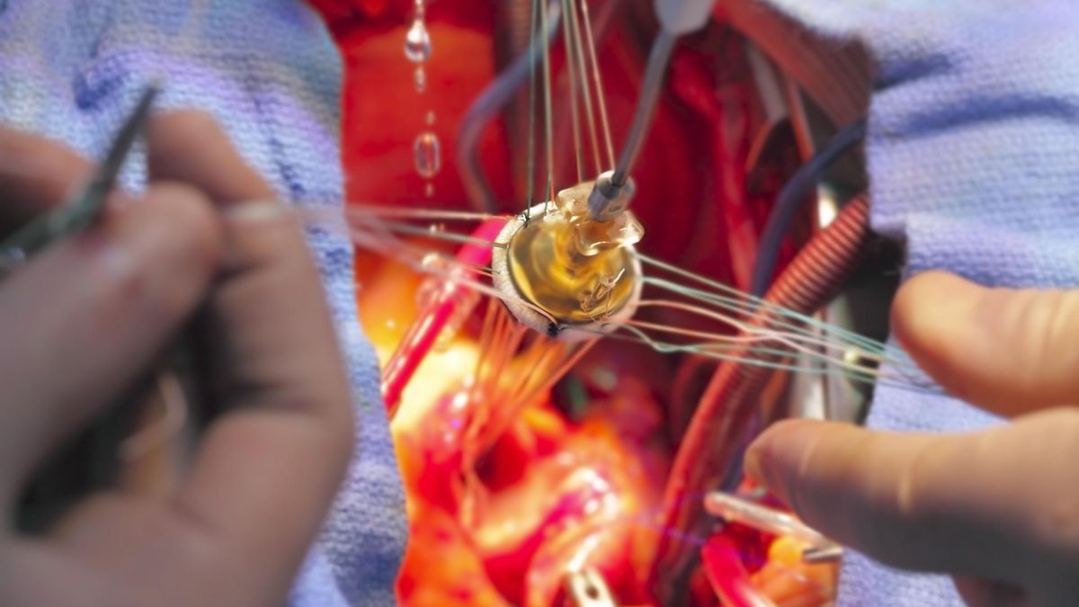 Aorta jest główną tętnicą organizmu, dzięki której natleniona krew dociera do wszystkich tkanek i organów