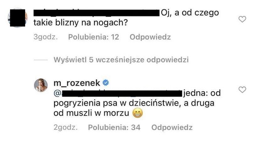 Komentarz Małgorzaty Rozenek