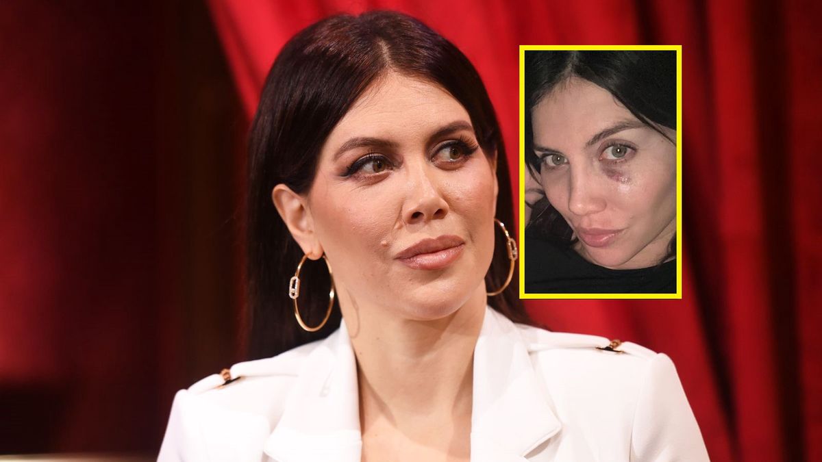 Wanda Nara uległa wypadkowi w czasie treningu tańca