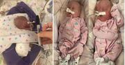 Malutkie bliźniaczki. Dziewczynki urodzone w 22. tygodniu ciąży przeżyły