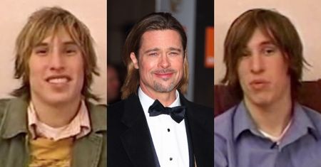 Bliźniacy Schlepp wydali 80 TYSIĘCY ZŁOTYCH, by wyglądać jak Brad Pitt: implanty w policzkach i podbródkach, nowe nosy, uzębienie