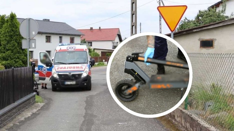 Urazy związane z wypadkami na hulajnogach to już prawdziwa plaga.