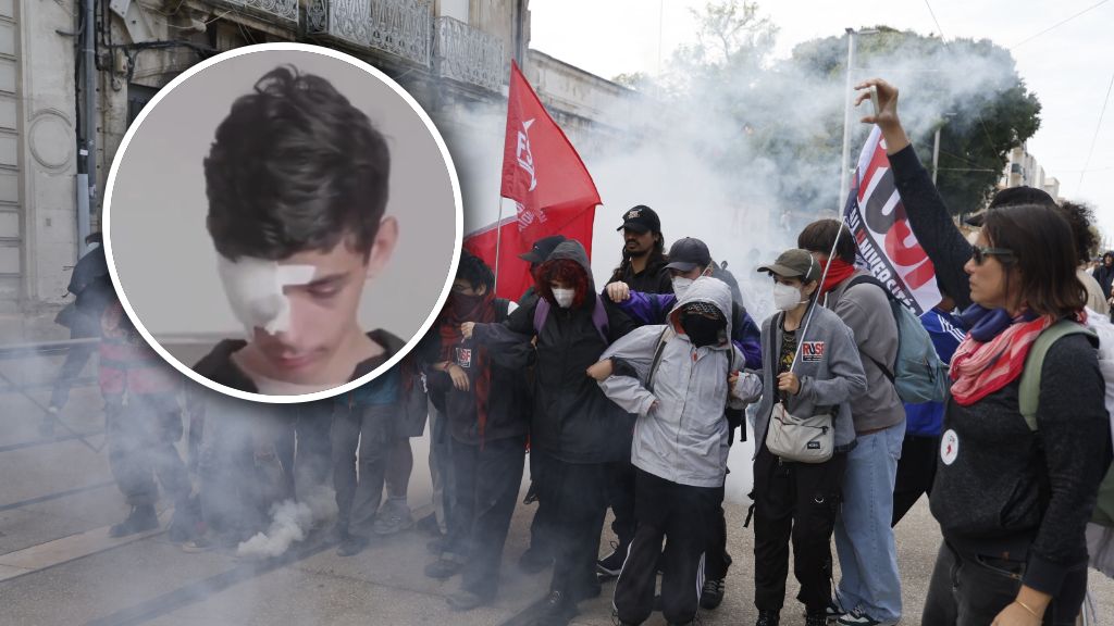 Rodzice nastolatka, który stracił oko domagają się odpowiedzialności policji