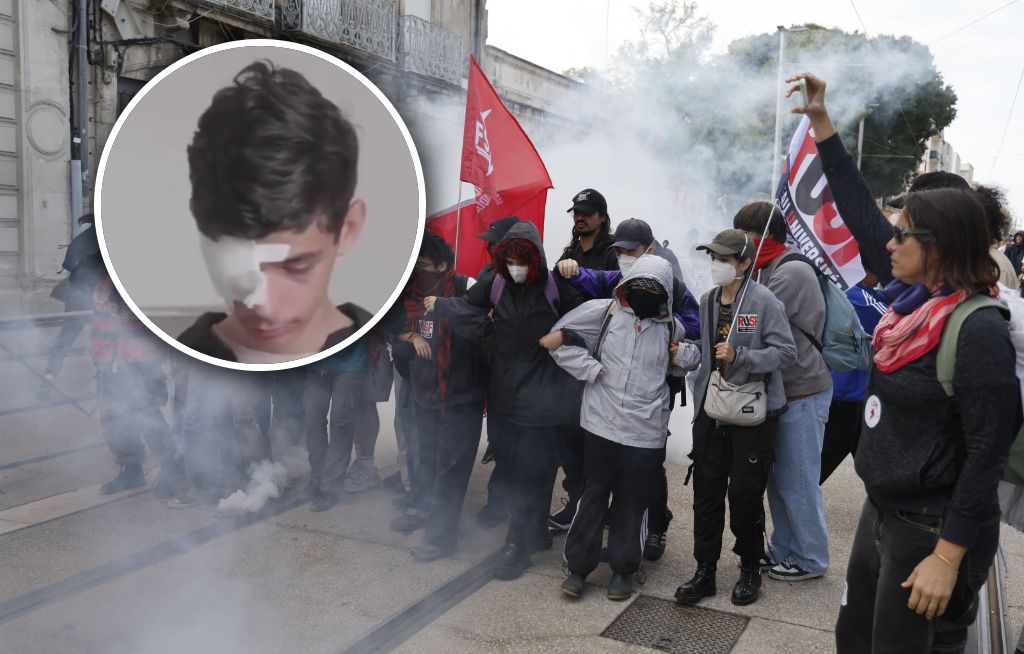 Stracił oko podczas protestów we Francji. Wina policji? Skarga rodziny