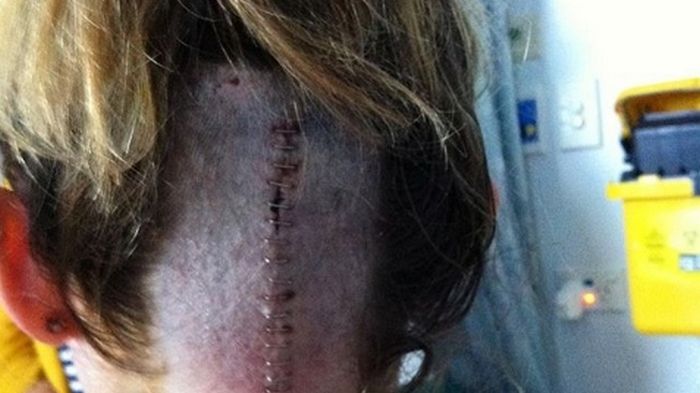 Amy Pejkovic przeszła trudną operację usunięcia guza mózgu