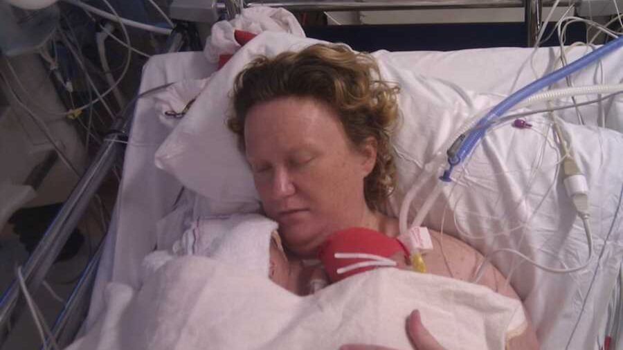 Przestraszyła się, kiedy zobaczyła swoje dzieci. Bliźniaczki urodziły się z rzadkim schorzeniem