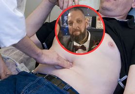 Rak jelit dał nagły, widoczny objaw. "Stało się to moich oczach"