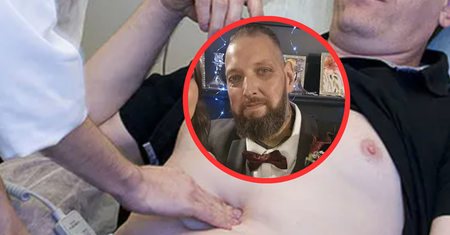 Rak jelit dał nagły, widoczny objaw. "Stało się to moich oczach"