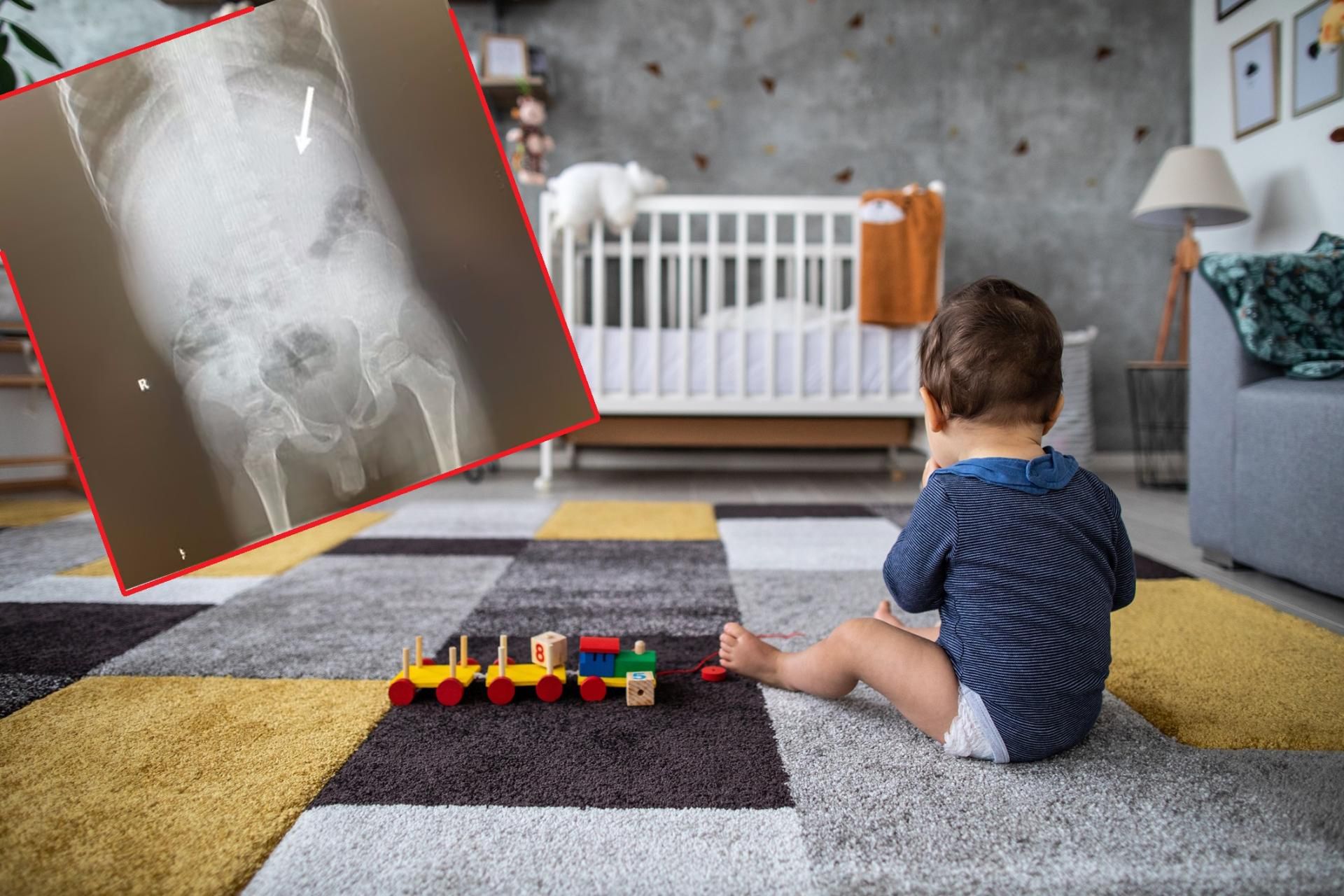 Połknięcie gumy przed dziecko