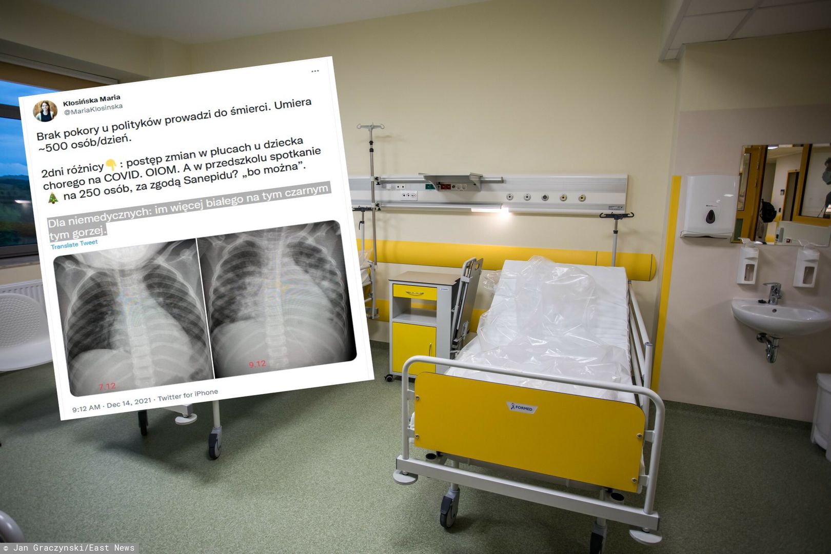 Zaledwie dwa dni. Takie spustoszenie choroba zrobiła w płucach