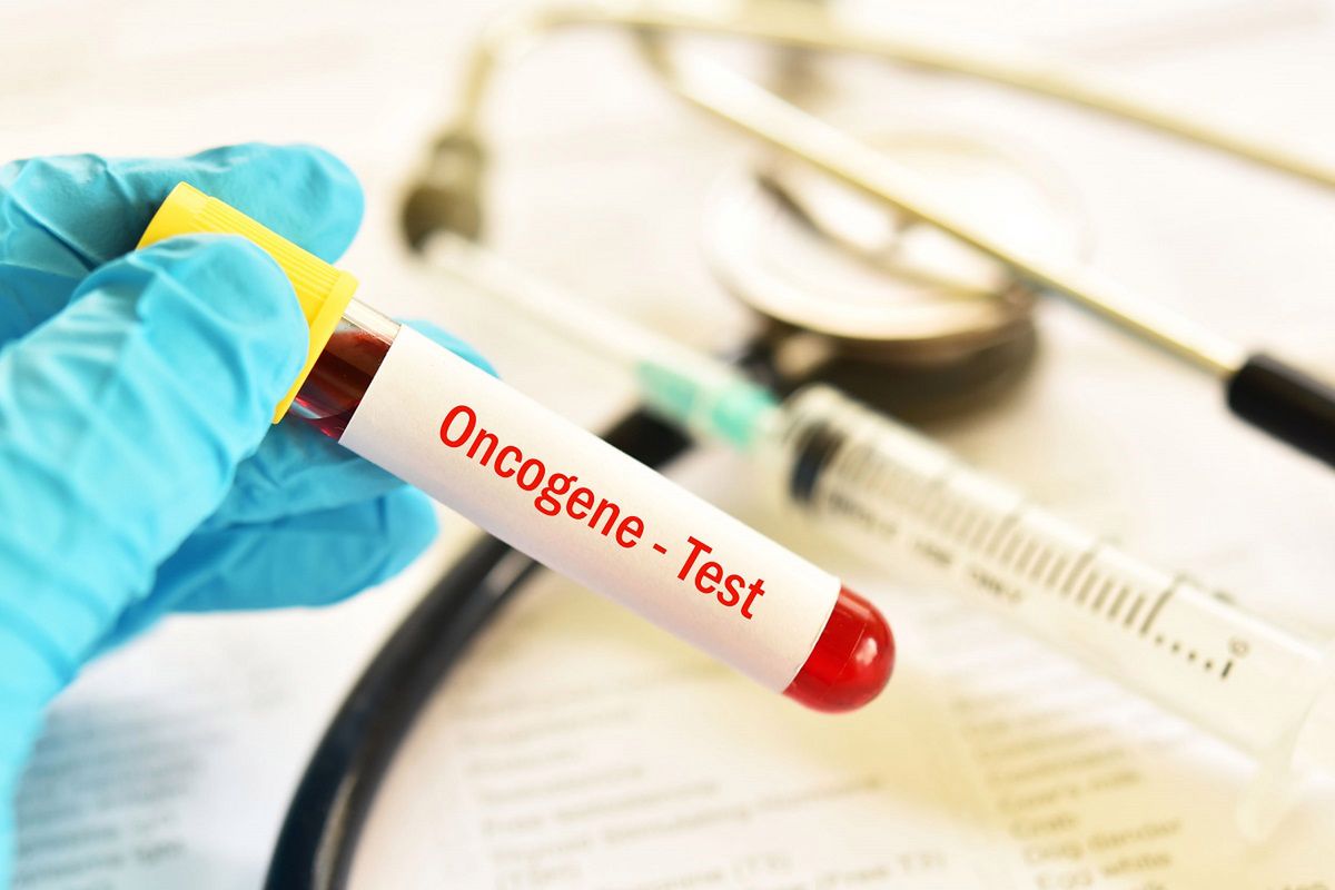 Jesz dużo czekolady? Naukowcy: To zwiększa ryzyko raka jelita grubego