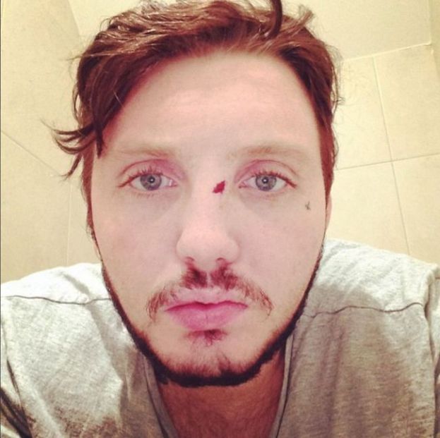 Obraz