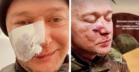 Ukraiński gwiazdor ranny na wojnie. "To z takimi nazistami walczycie"
