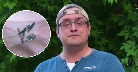 Lekarz pokazał chipy, które ma pod skórą. "To znacznie ułatwia życie"