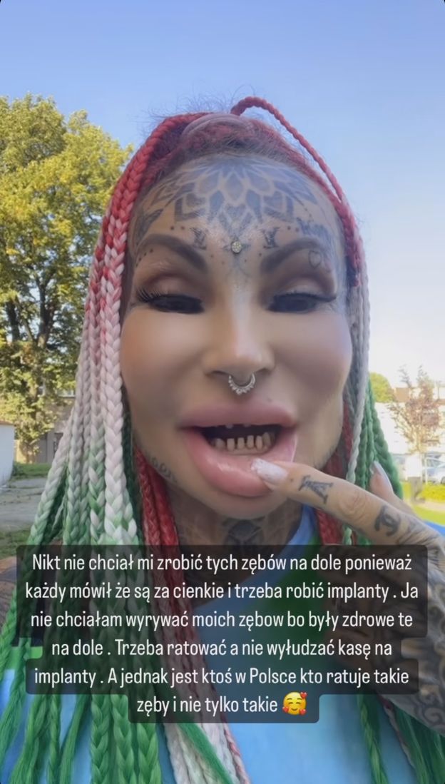 "Królowe życia". Adrianna Eisenbach SPIŁOWAŁA ZĘBY. Do twarzy jej z takimi igiełkami? (WIDEO)
