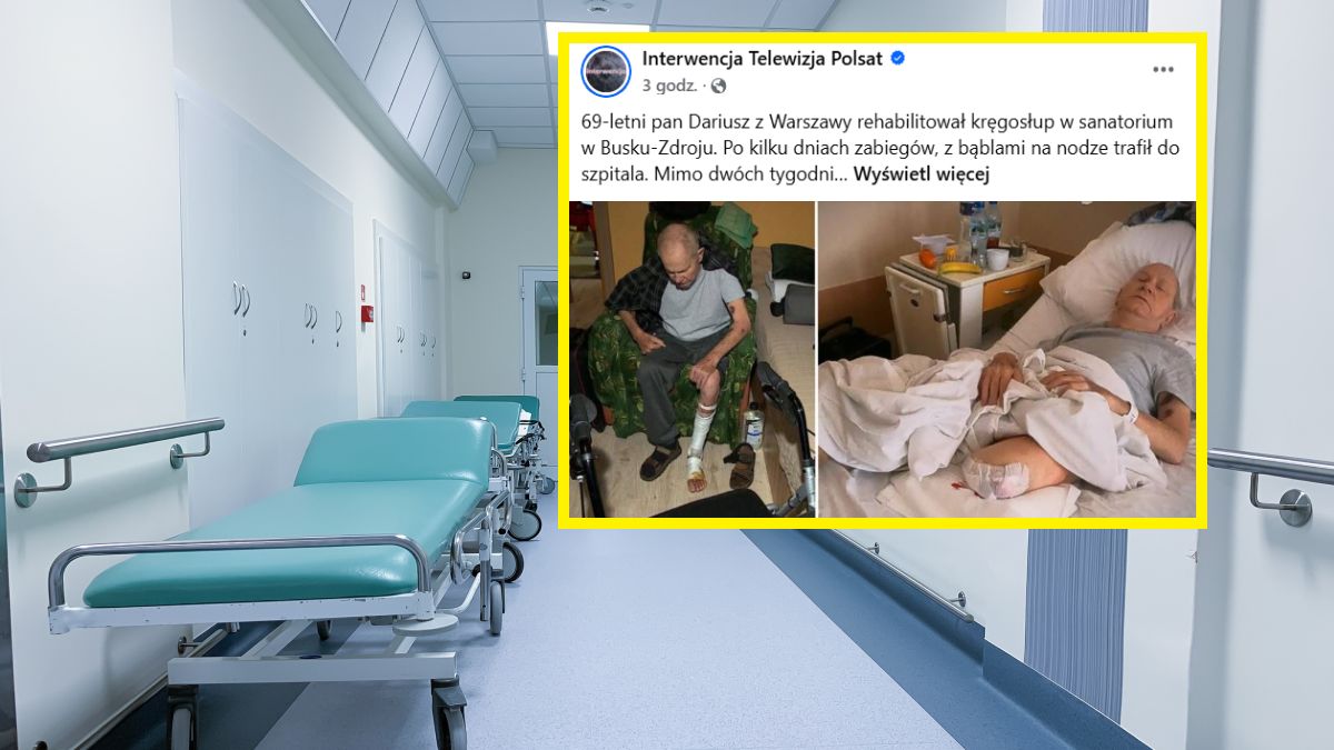 Doszło do amputacji nogi