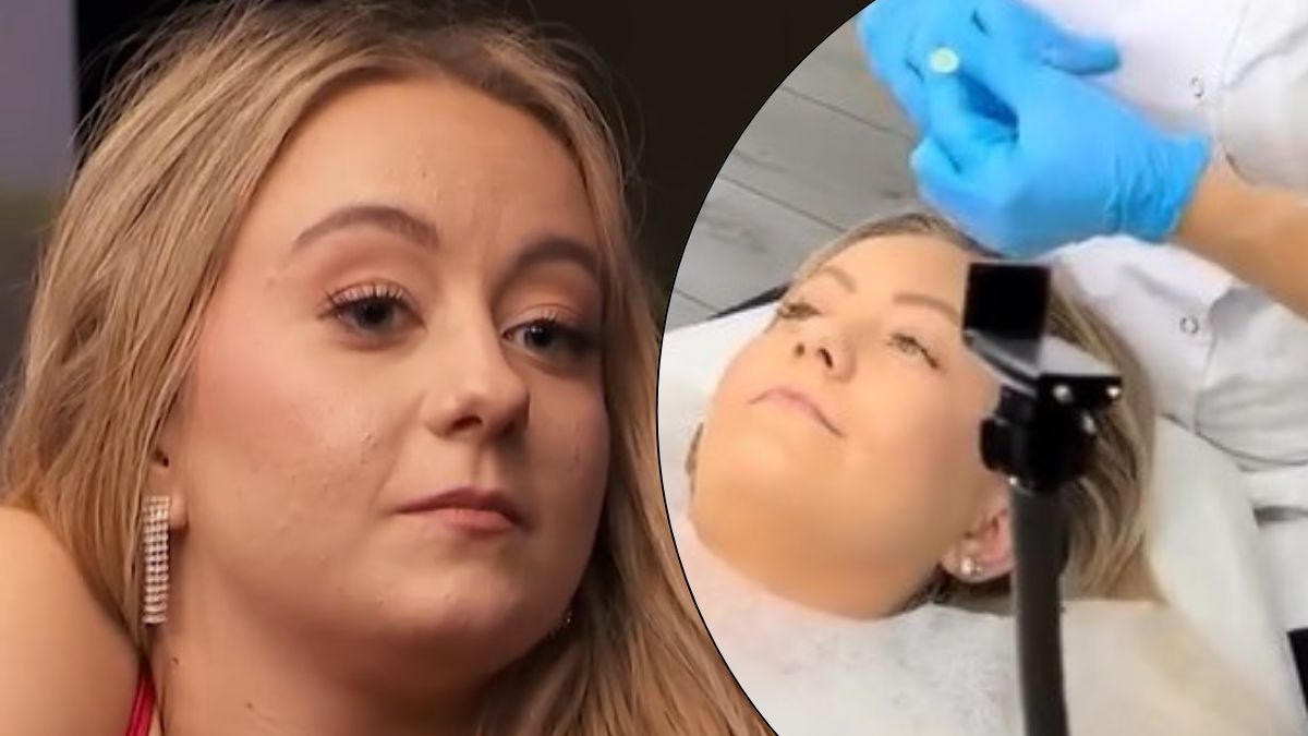 Nicola z "Rolnik szuka żony" zdecydowała się ne zabieg powiększający usta