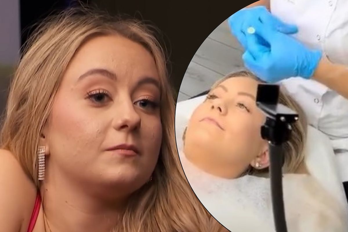 Nicola z "Rolnik szuka żony" pokazała nowe usta. Internauci podzieleni