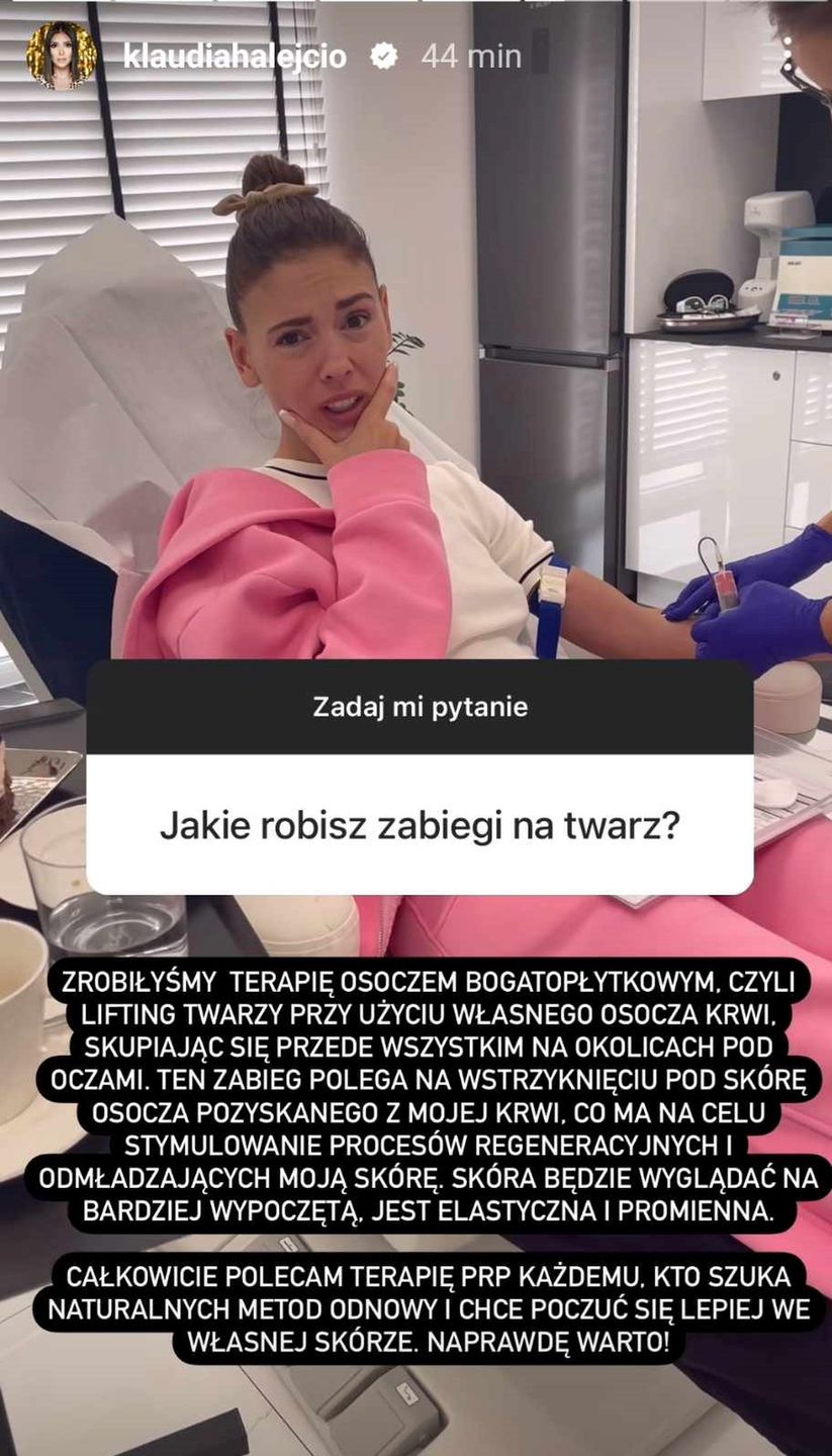 Klaudia Halejcio wymienia zabiegi medycyny estetycznej, jakim się poddała