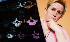 Zanim doczeka się operacji, zostanie kaleką