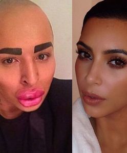 23-latek wydał pół miliona złotych, żeby wyglądać jak Kim Kardashian