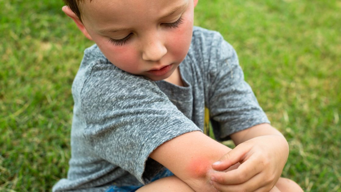 Jak odstraszyć komary- Pyszności, źródło: Canva