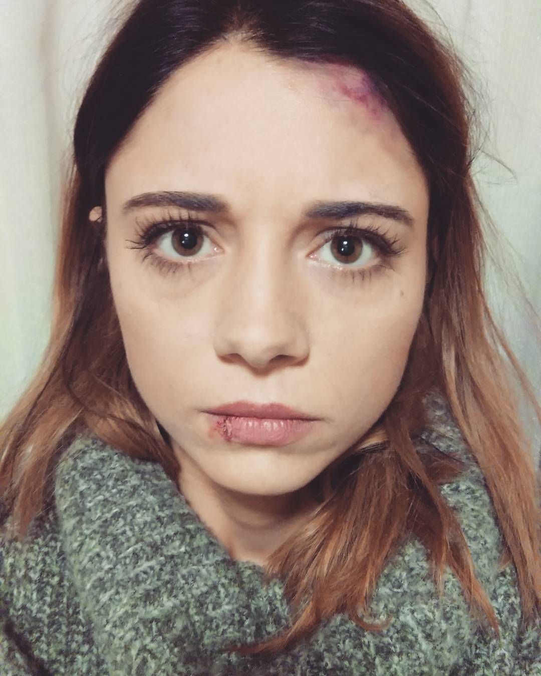 Adriana Kalska pobita