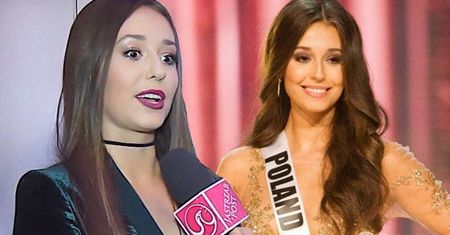 Izabella Krzan po raz pierwszy szczerze o swoich kompleksach! Miss Polonia miała duże problemy!